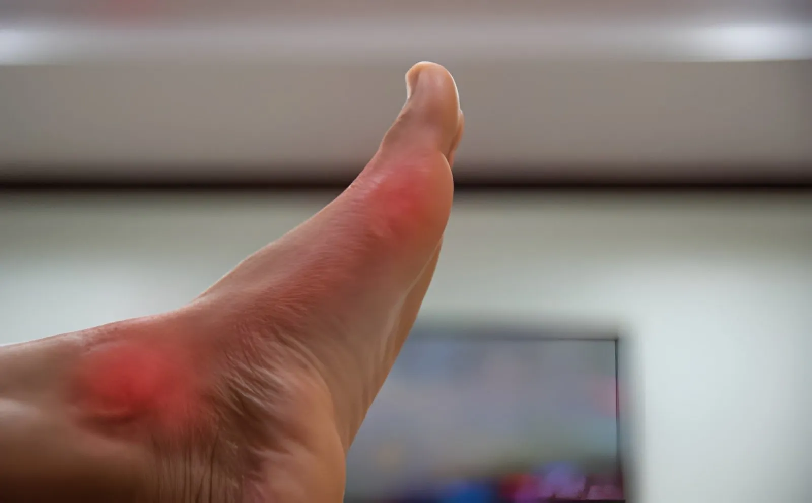 Don’t Ignore the Signs: Identifying Common Foot Infections